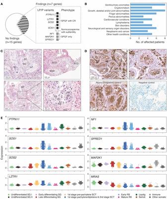 Undiagnosed RASopathies in infertile men